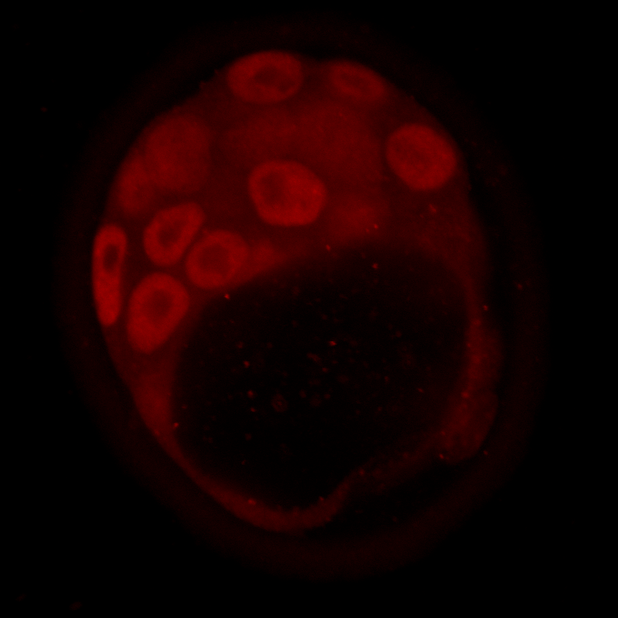 blastocyst red.tif